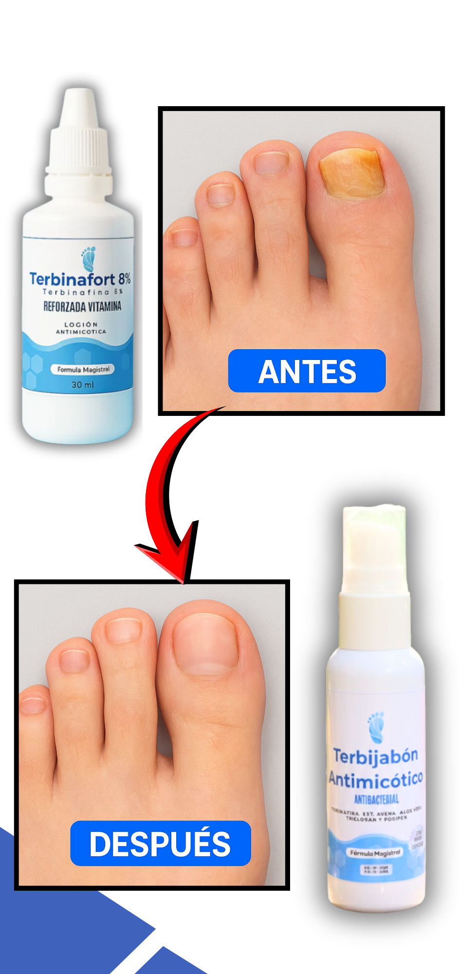 Terbinafort 8% + Terbijabón