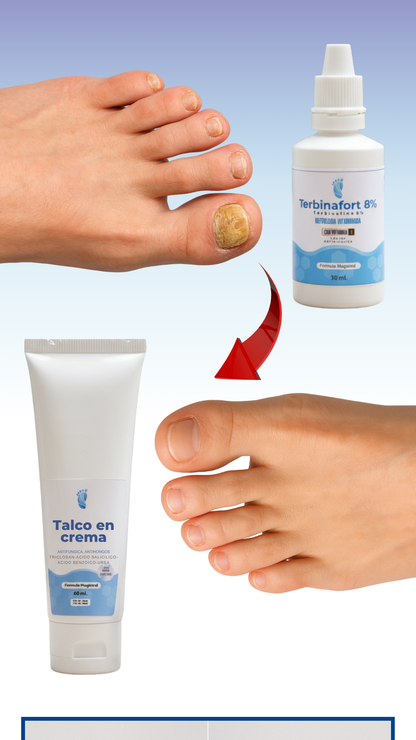 PACK VERANO (TERBINAFORT + TALCO EN CREMA)