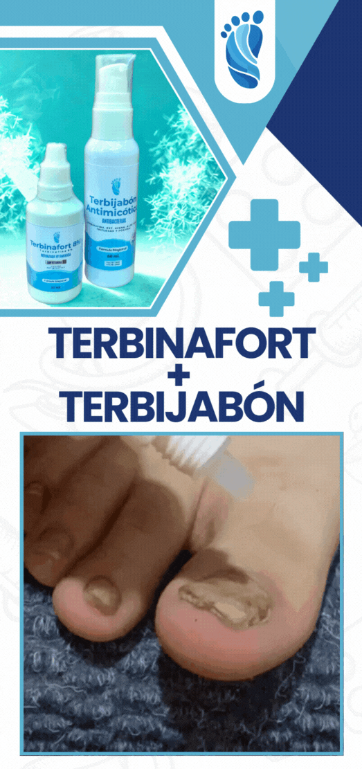 Terbinafort 8% + Terbijabón